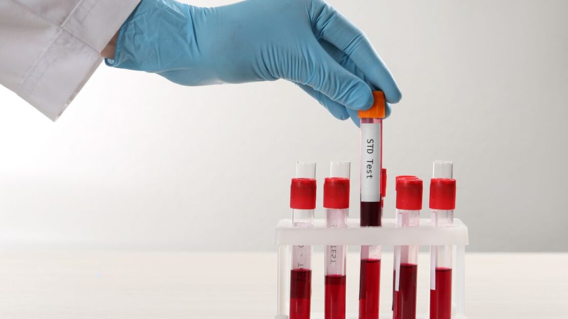 Should You Get Tested for STDs If You Don't Have Symptoms?