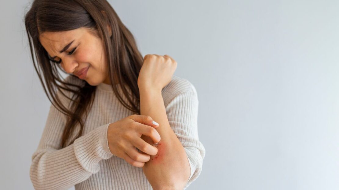 How Urgent Care Can Help You with Dermatitis, Shingles, and Other Skin Conditions